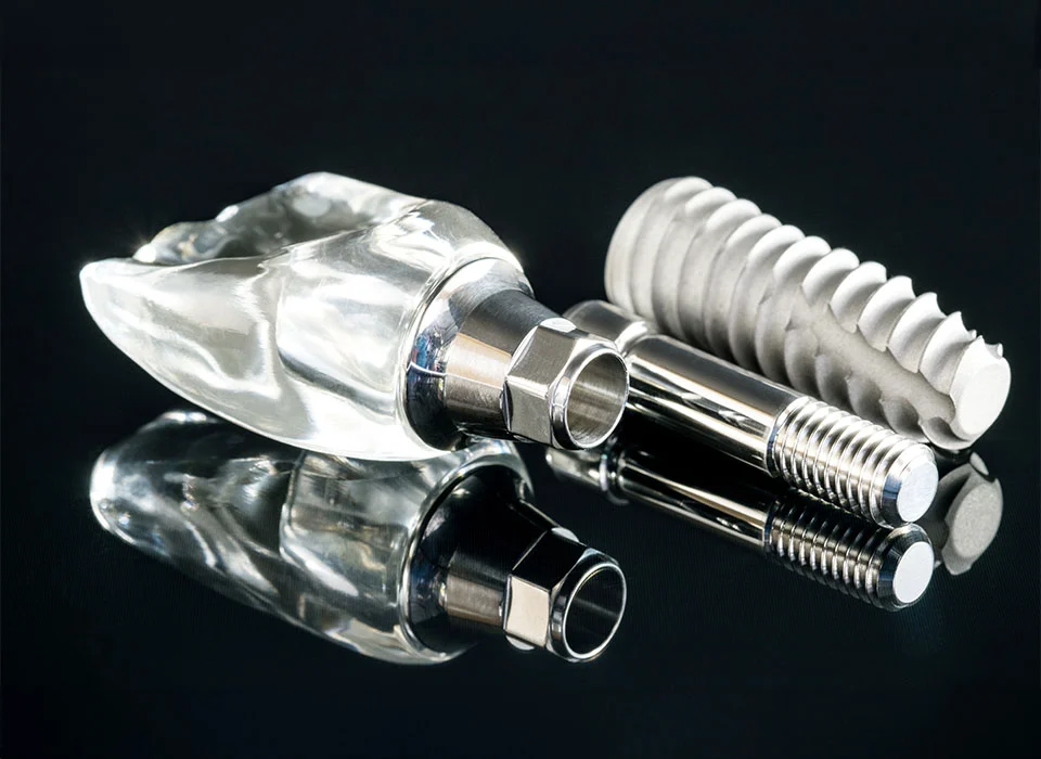 Dental implants on black reflective table - Dental Implants in Beverly Hills, Ca